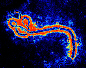 Ebola virus transmission electron micrograph image colorized Original image from CDC