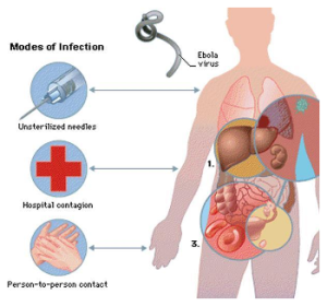 ebolavirusdiseasepicture